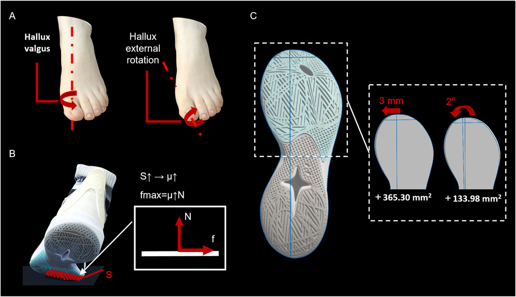 Diagram illustrating foot alignment and shoe sole grip. Panel A shows a foot with hallux valgus and external rotation indicated by arrows. Panel B displays a shoe demonstrating friction force concepts with arrows and formulas. Panel C shows a shoe sole design with detailed views, illustrating adjustments of three millimeters and two degrees, increasing surface area by 365.30 and 133.98 square millimeters.
