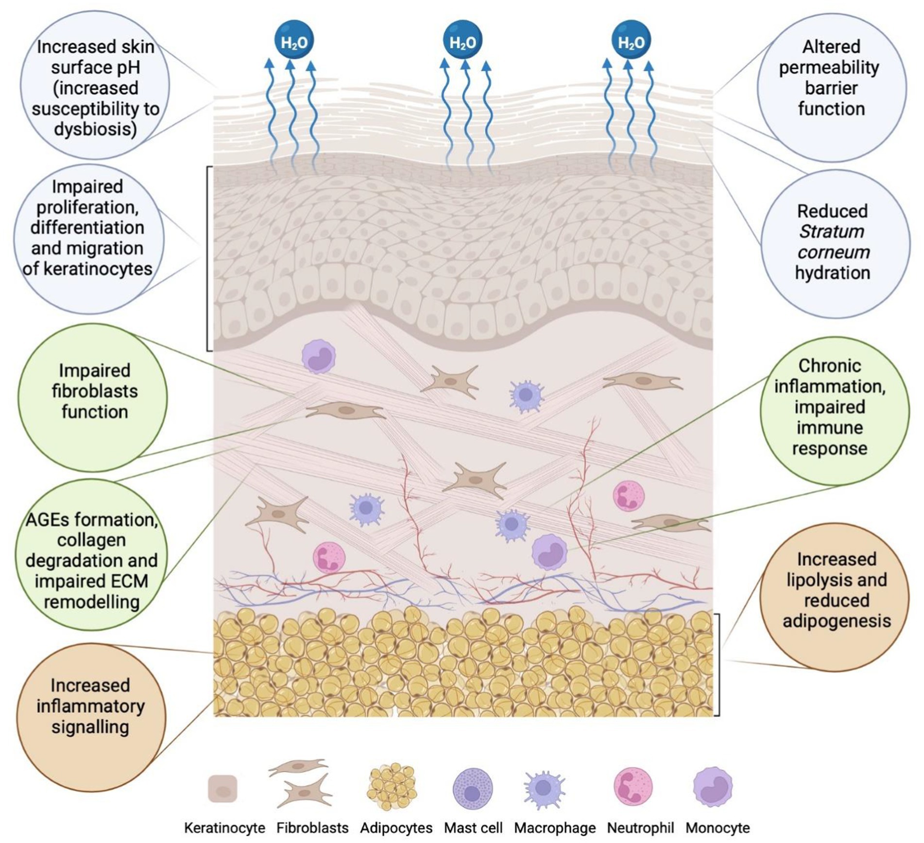 Illustration depicting skin layers with various cellular components like keratinocytes, fibroblasts, and adipocytes. Arrows indicate water loss, with labels describing effects such as impaired fibroblast function, chronic inflammation, and increased inflammatory signaling. Key issues include altered permeability, stratum corneum hydration, and increased skin surface pH. Legends describe the cell types.