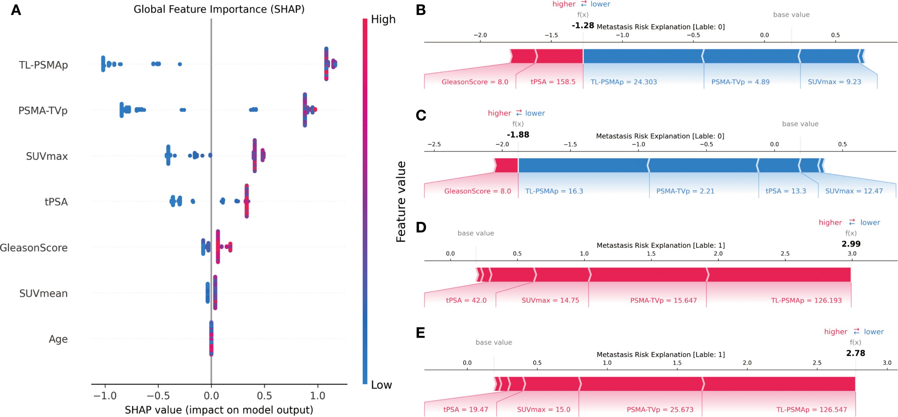 A series of charts showing SHAP analysis for model output related to metastasis risk. Panel A displays global feature importance with features like TL-PSMAp, GleasonScore, and Age impacting the model. Panels B to E represent SHAP force plots explaining individual predictions, with red indicating higher risk and blue indicating lower risk. Each plot includes feature values like GleasonScore and tPSA, alongside impact on the model's output.