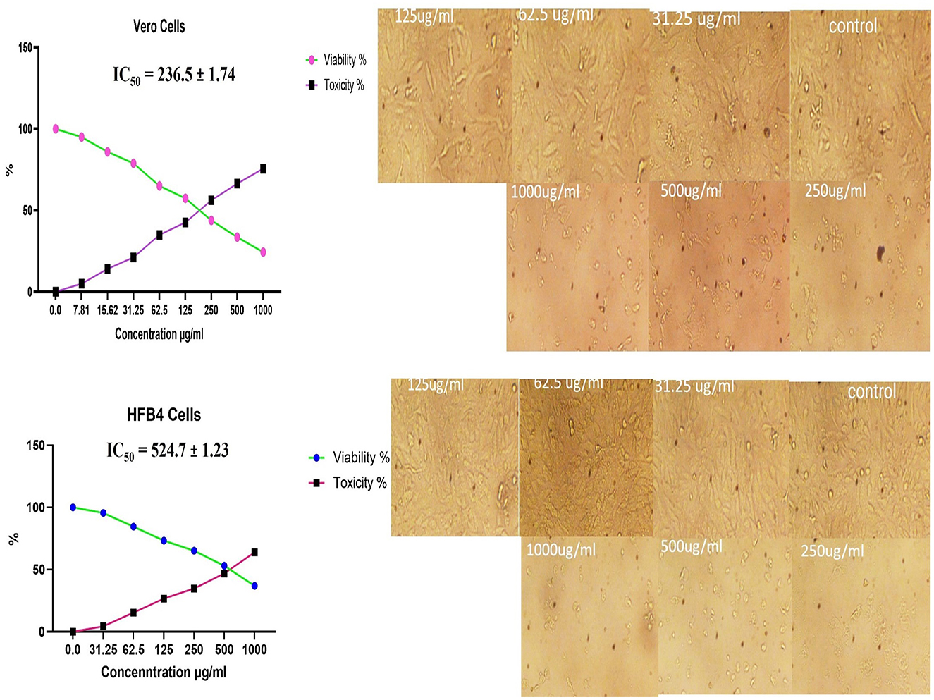 Graphs and microscope images illustrate the effects of different concentrations on Vero and HFB4 cells. The Vero cells graph shows viability and toxicity percentages plotted against increasing concentrations, with an IC₅₀ of 236.5 ± 1.74. The HFB4 cells graph shows similar data, with an IC₅₀ of 524.7 ± 1.23. Adjacent microscope images display cellular changes at concentrations ranging from 0 to 1000 micrograms per milliliter for both cell types.