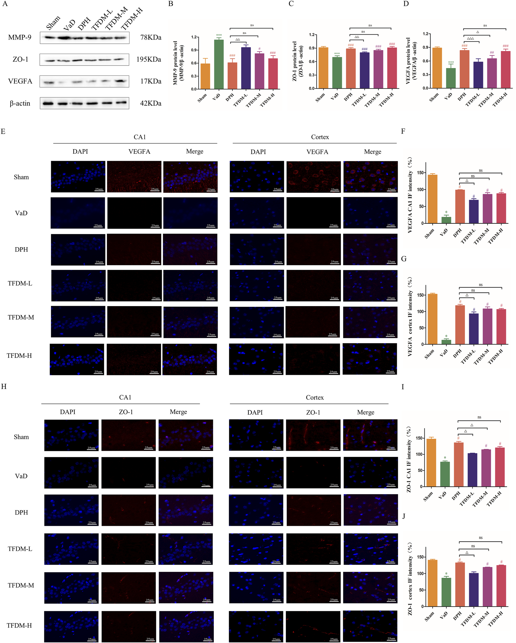 Composite figure displaying protein expression analysis and immunofluorescence microscopy. Panel A shows western blot results for MMP-9, ZO-1, VEGFA, and β-actin across different treatments. Panels B, C, and D present bar graphs illustrating the expression levels of MMP-9, ZO-1, and VEGFA, respectively, under various conditions. Panel E features protein localization using DAPI and VEGFA staining in CA1 and cortex regions, with corresponding bar graphs F and G. Panel H shows DAPI and ZO-1 staining, with bar graphs I and J. Statistical comparisons are denoted, emphasizing significant differences among groups.