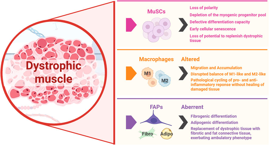 Illustration of dystrophic muscle, highlighting issues with MuSCs, macrophages, and FAPs. MuSCs show loss of polarity, depletion, defective differentiation, and senescence. Macrophages have altered migration, accumulation, M1/M2 balance, and pathological cycling. FAPs display aberrant fibrogenic and adipogenic differentiation, leading to tissue replacement with fibrotic and fat connective tissue, exacerbating ambulatory issues.