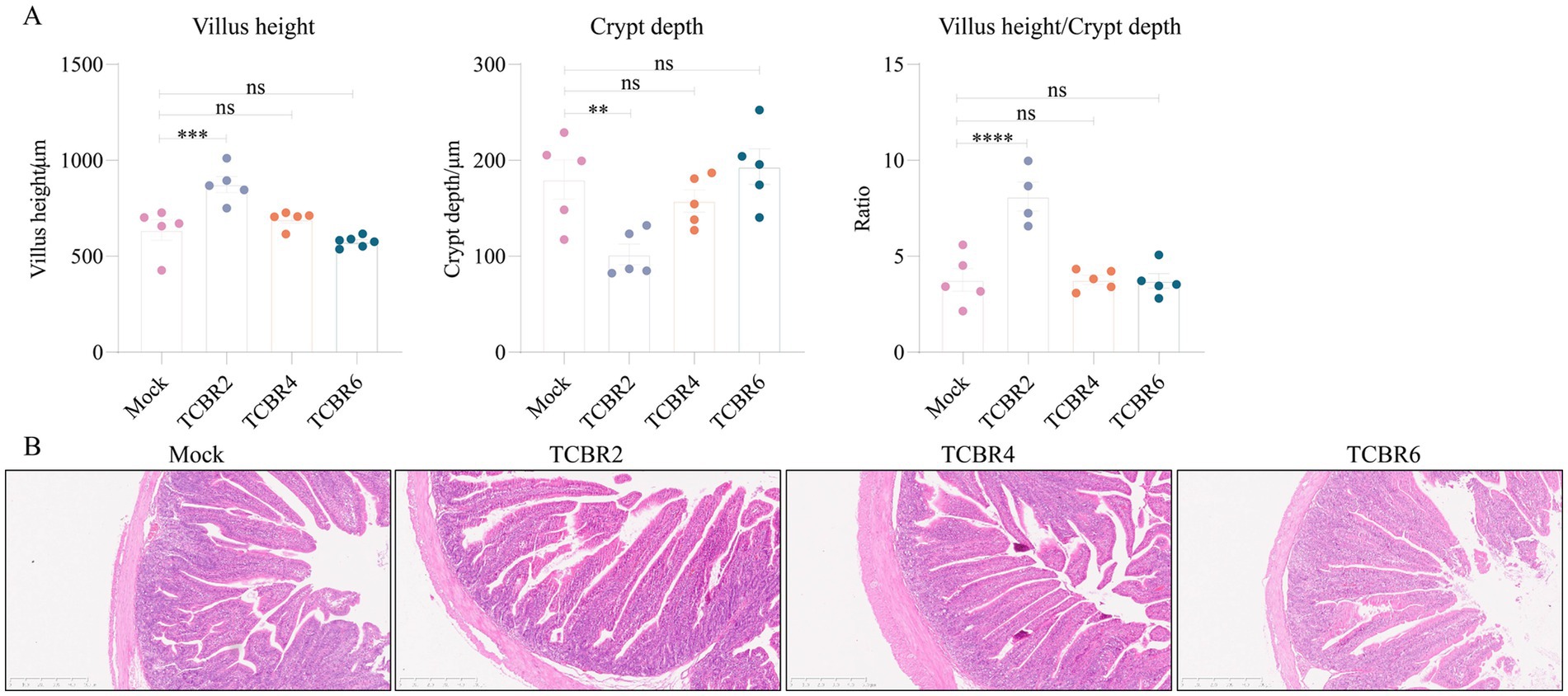 Graphs and histological images illustrate intestinal villus height, crypt depth, and villus-to-crypt ratio across different samples labeled Mock, TCBR2, TCBR4, and TCBR6. Graphs show significant differences marked with asterisks, while histological sections show tissue morphology for each sample.