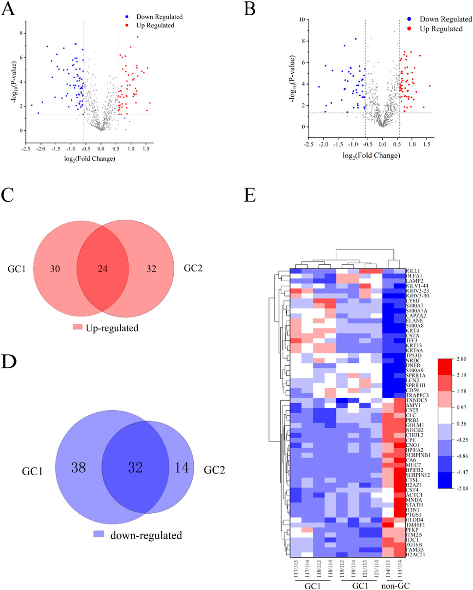 Graphs and a heatmap illustrate gene expression analysis. Graphs A and B are volcano plots showing upregulated genes in red and downregulated genes in blue. Venn diagrams C and D display overlapping upregulated and downregulated genes between groups GC1 and GC2. E is a heatmap representing gene expression levels across different samples, with colors indicating expression intensity from blue (low) to red (high).
