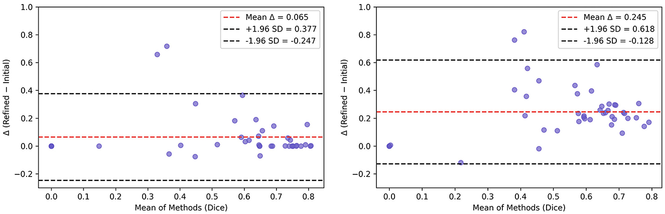 Two Bland Altman plots compare the mean of methods (Dice) to the difference between refined and initial results. The left plot has a mean Δ of 0.065 with limits at 0.377 and -0.247. The right plot has a mean Δ of 0.245 with limits at 0.618 and -0.128. Data points are distributed around the mean lines.