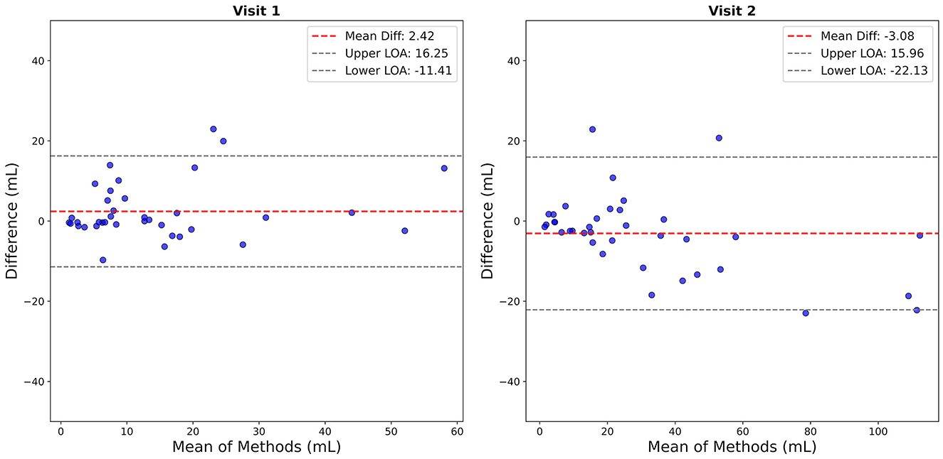 Bland-Altman plots comparing two methods over two visits. The left plot (Visit 1) shows blue dots scattered around the red mean difference line at 2.42 milliliters, with limits of agreement (LOA) at 16.25 and -11.41 milliliters. The right plot (Visit 2) has the mean difference at -3.08 milliliters, and LOA at 15.96 and -22.13 milliliters. Each plot displays data points with variation around the mean line, indicating differences in measurement methods.