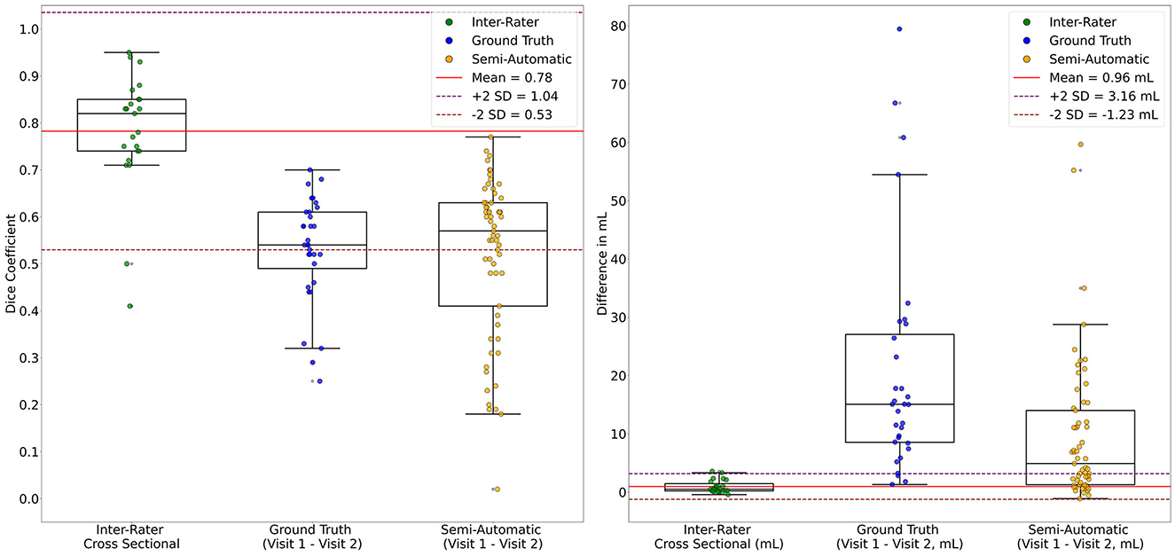 Box plots show Dice coefficients and volume differences across three measurement methods: Inter-Rater, Ground Truth, and Semi-Automatic. Left plot: Dice coefficients; right plot: volume differences. Mean, plus and minus two standard deviations are marked with dashed lines.