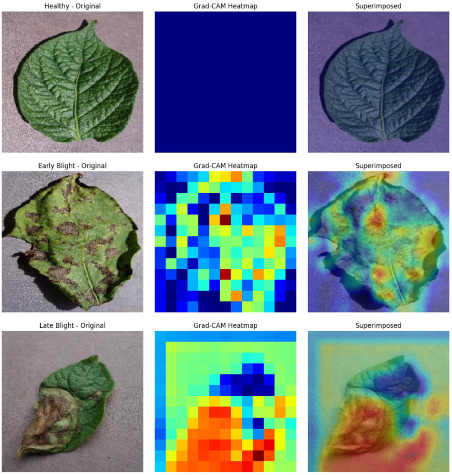 First row shows a healthy leaf, a blank Grad-CAM heatmap, and a superimposed image of the leaf. Second row shows an early blight-affected leaf, its Grad-CAM heatmap with varied colors, and the superimposed image highlighting affected areas. Third row displays a late blight-affected leaf, its colorful Grad-CAM heatmap, and the superimposed image emphasizing the blight regions.