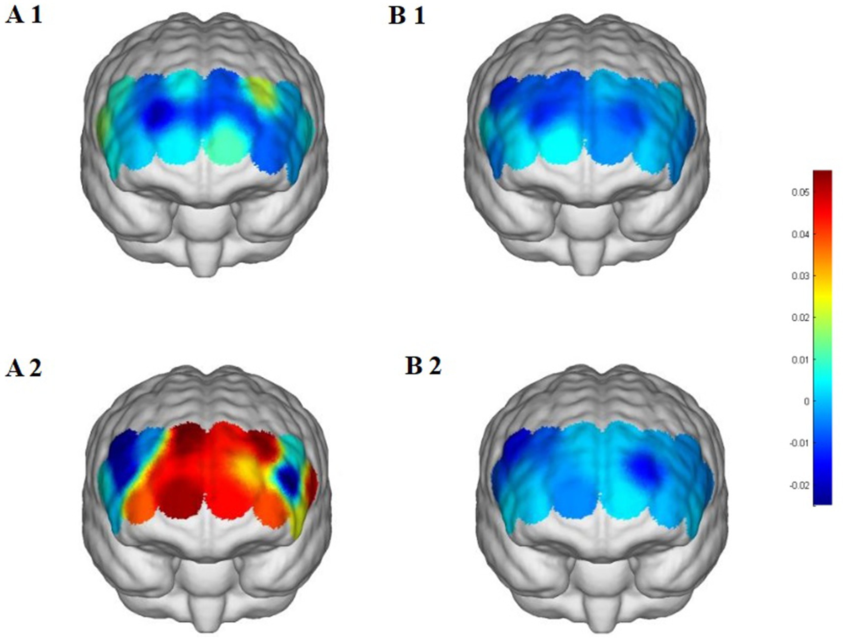 Top and bottom rows each show two colored brain maps labeled A1, B1, A2, and B2. A1 and B2 display blue and green areas, indicating lower activity. A2 shows red and orange, suggesting higher activity. A color scale on the right ranges from -0.02 (blue) to 0.05 (red).