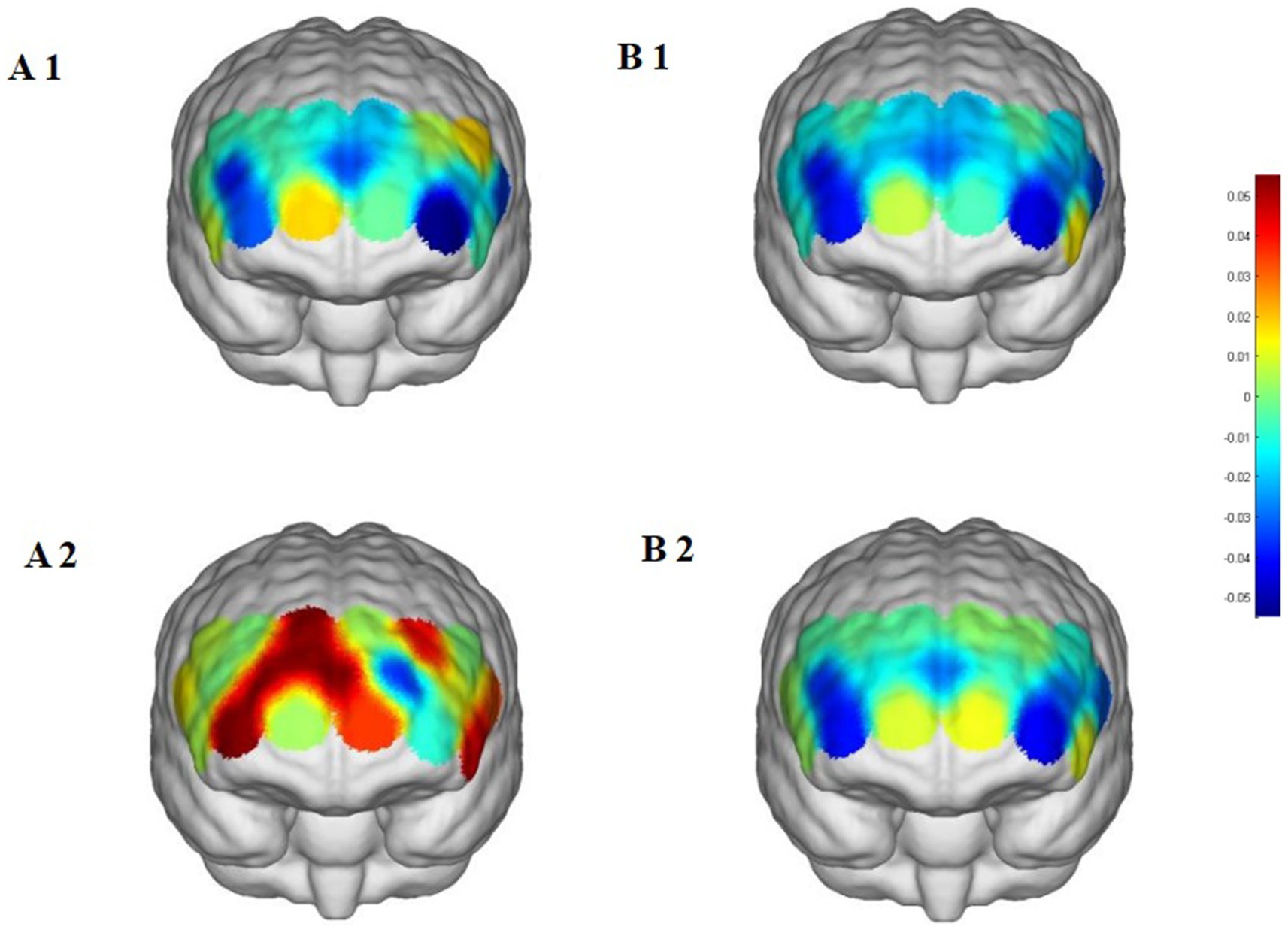 Four brain models labeled A1, A2, B1, and B2 show topographical data using a color scale from blue to red, indicating varying levels of activity or measurement. A1 and B1 display cooler colors, while A2 shows warmer tones, particularly red. A color scale on the side ranges from -0.05 to 0.05.