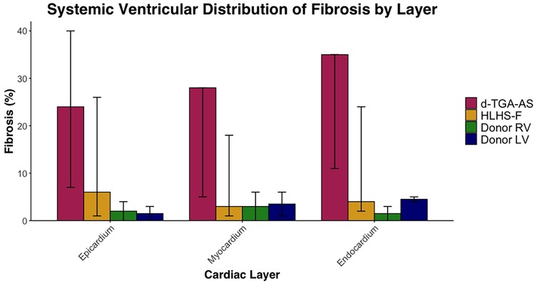 Bar chart showing systemic ventricular distribution of fibrosis by cardiac layer: epicardium, myocardium, and endocardium. Categories include d-TGA-AS, HLHS-F, Donor RV, and Donor LV. d-TGA-AS shows the highest fibrosis across all layers, with significant differences noted against other categories. Fibrosis is measured as a percentage.