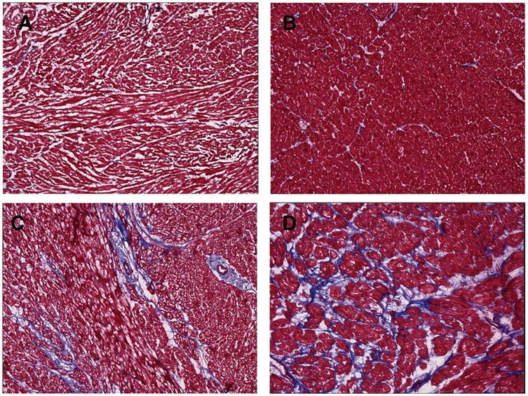 Histological images showing four muscle tissue samples labeled A, B, C, and D. Each sample displays different patterns of red-stained muscle fibers interwoven with varying amounts of blue-stained connective tissue. The arrangement and density of fibers differ between samples, indicating differences in tissue structure or condition.