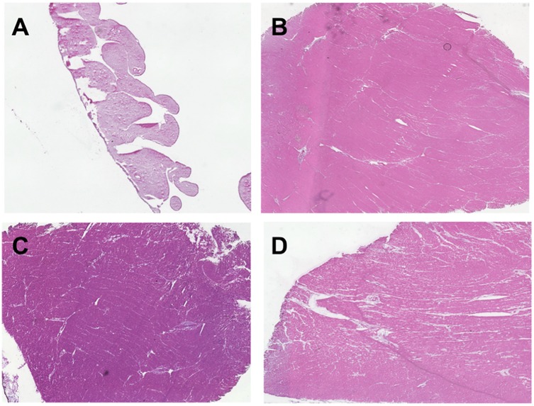 Microscopic images of heart muscle samples labeled A, B, C, D. Image A shows RV muscle from a control. Images B, C, D show heart muscle from LV, a systemic RV in HLHS-F and systemic RV in dTGA-AS.