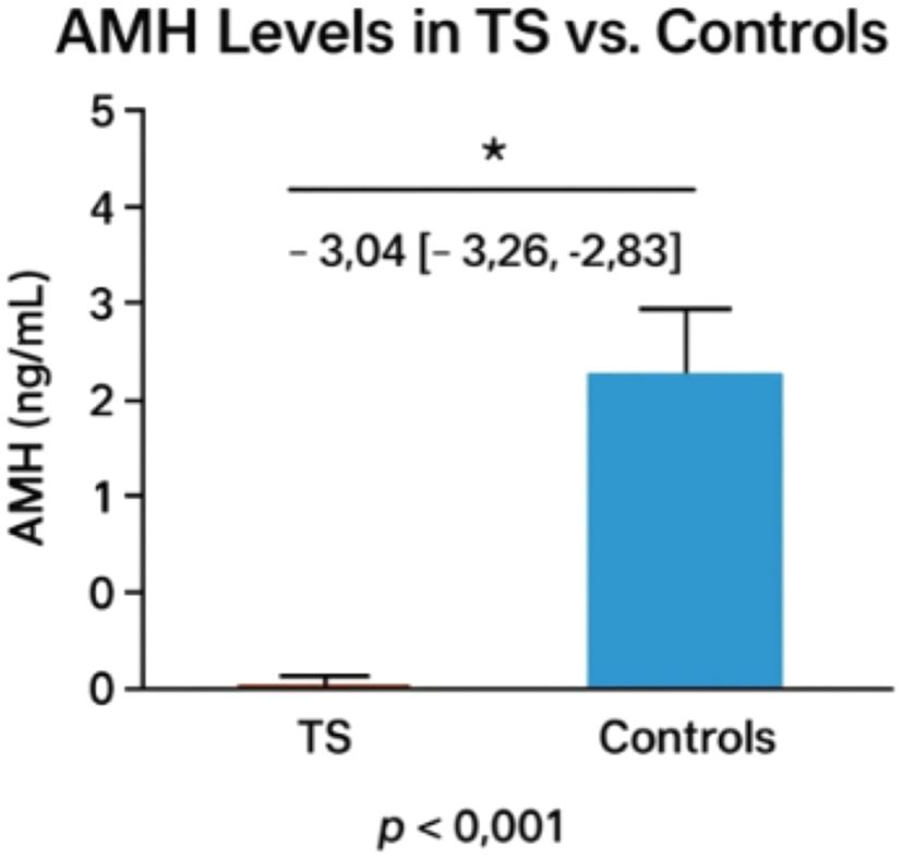 Bar chart comparing AMH levels in Turner Syndrome (TS) versus control groups. TS shows levels near zero, while controls have significantly higher levels around 3.5 nanograms per milliliter. The difference is significant with p-value less than 0.001.