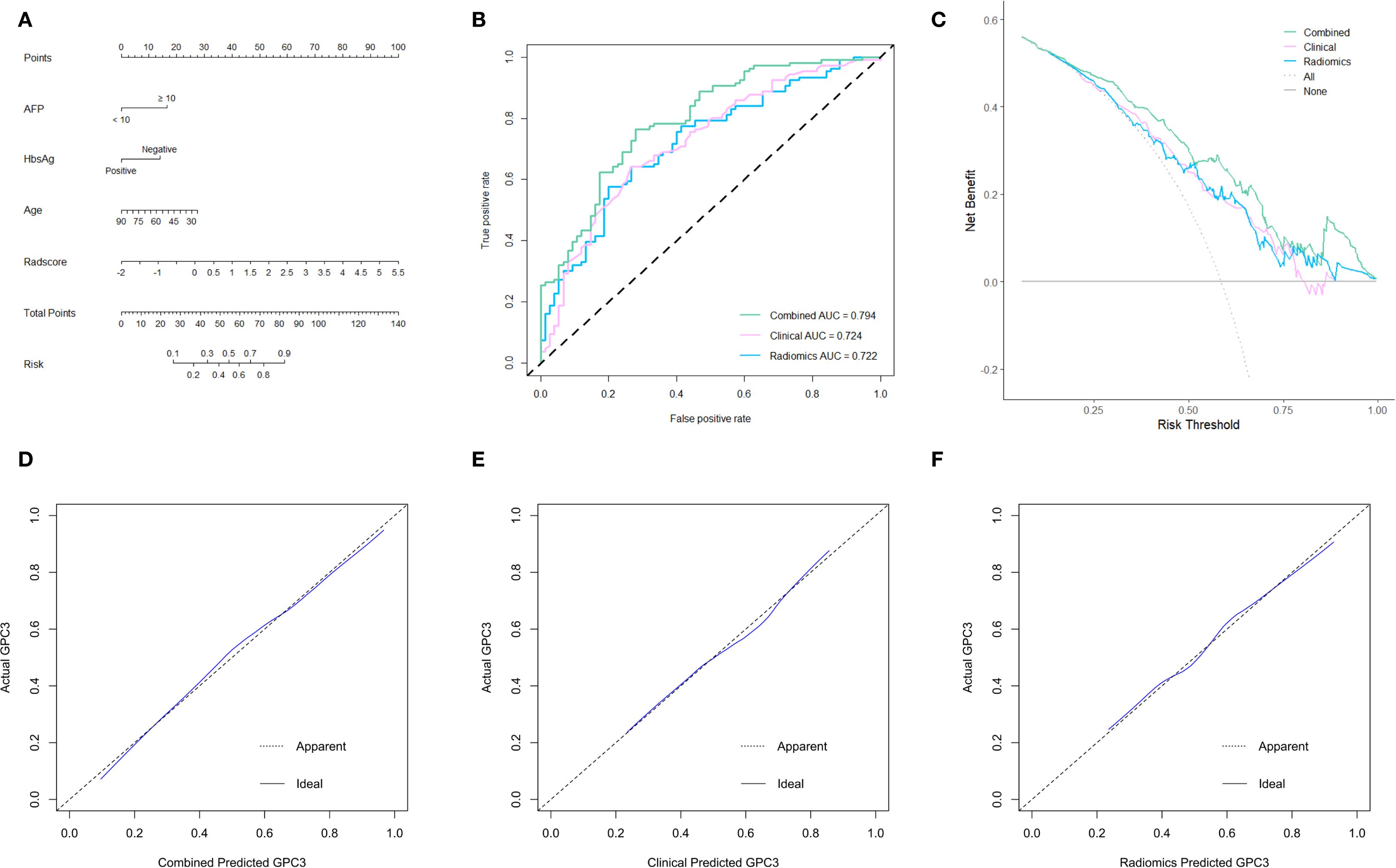 Panel A displays a nomogram with points based on AFP, HbsAg status, age, and radscore. Panel B shows a ROC curve comparing combined, clinical, and radiomics AUCs. Panel C is a decision curve analysis with net benefit versus risk threshold. Panels D, E, and F depict calibration plots for combined, clinical, and radiomics predicted GPC3, respectively, comparing apparent and ideal lines.