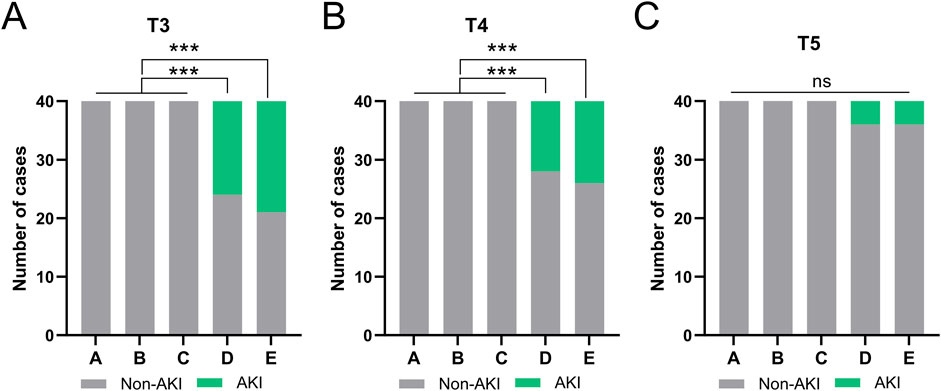 Bar graphs labeled A, B, and C represent the number of cases for Non-AKI (gray) and AKI (green) conditions across groups A to E. In T3 and T4, there are significant differences (indicated by asterisks) between groups, with a noticeable increase in AKI cases. In T5, no significant differences are observed.