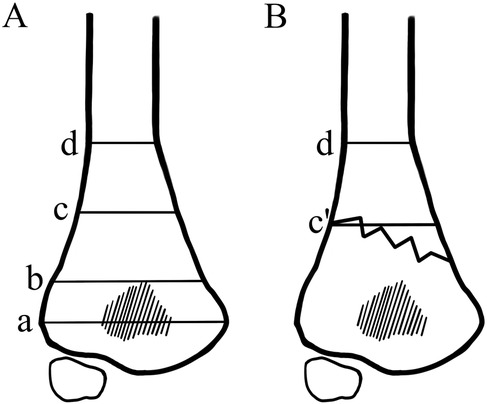 Diagram showing two side-by-side line drawings labeled A and B, depicting anatomical structures with sections marked as a, b, c, d, and c'. Both feature a shaded area on the lower section marked a, and A has straight section lines while B has a jagged line at c'.