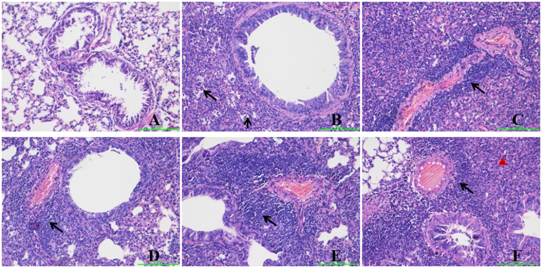 Microscopic images depicting lung tissue with inflammation. Images A to F show varying degrees of cellular infiltration and structural changes, with arrows indicating specific areas of inflammation and a red arrowhead highlighting a notable structure in image F. Each image provides a different view of histological alterations in the tissue.