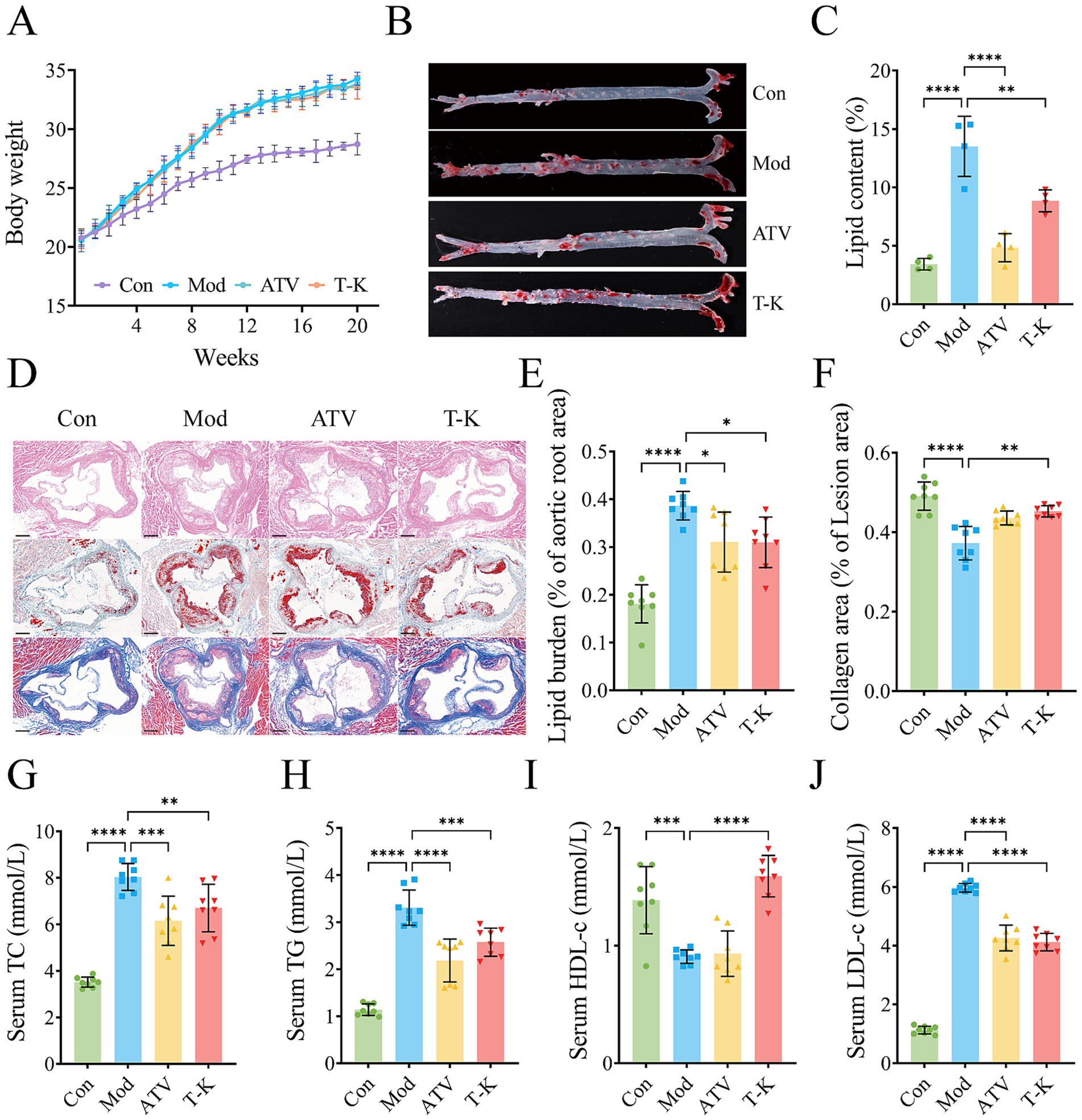 A multi-panel scientific figure showing comparisons between control (Con), model (Mod), ATV, and T-K groups. Panel A depicts a line graph of body weight over 20 weeks. Panel B shows aortic sections, highlighting lipid areas. Panel C presents a bar chart of lipid content percentages. Panel D features histological images of tissue samples. Panel E displays a bar chart of lipid burden in the aortic root. Panel F shows collagen area percentages. Panels G to J respectively illustrate serum TC, TG, HDL-c, and LDL-c levels with bar charts. Asterisks indicate varying levels of statistical significance.