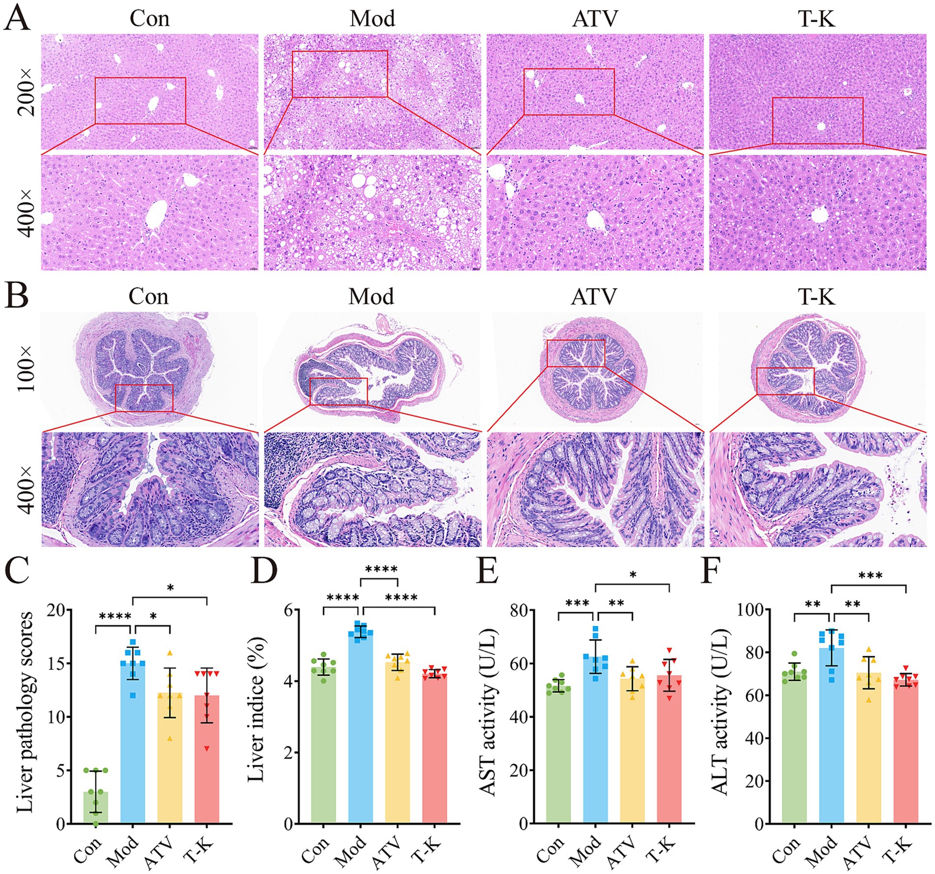 The image shows a series of data visualizations related to microbial diversity indices across four treatment groups: Con, Mod, ATV, and T-K. Panel A displays Shannon curves with different index readings based on the number of reads sampled. Panels B through G present violin plots showing one-way ANOVA results for Ace, Chao, Shannon, Simpson, Sobs, and Coverage indices, each illustrating significant differences between groups at various significance levels. Panel H features a PLS-DA plot indicating clustering of the four groups based on OTU level. Panel I presents a PCoA plot with principal component analysis, highlighting variance between groups.