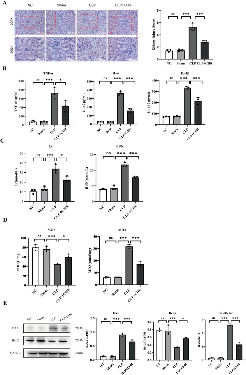 A composite image containing five panels labeled A to E. Panel A: Histological images of kidney tissue with a bar graph showing kidney injury scores for groups labeled NC, Sham, CLP, and CLP+CHR. Panel B: Bar graphs showing levels of TNF-α, IL-6, and IL-1β in pg/ml for the same groups. Panel C: Bar graphs showing creatinine (Cr) and blood urea nitrogen (BUN) levels in nmol/L. Panel D: Bar graphs depicting levels of superoxide dismutase (SOD) in U/mg and malondialdehyde (MDA) in nmol/mg. Panel E: Western blot results for BAX, Bcl-2, and GAPDH with corresponding bar graphs for BAX/GAPDH, Bcl-2/GAPDH, and BAX/Bcl-2 ratios. Statistical significance is indicated by asterisks.