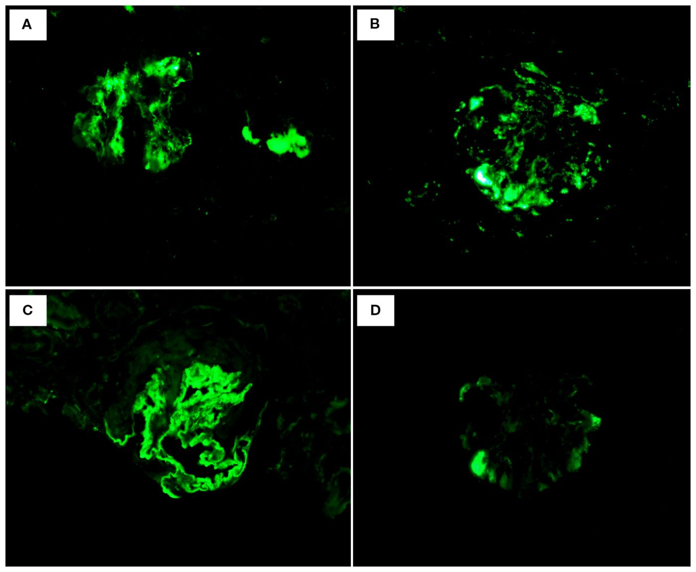Microscopic images labeled A to D show green fluorescent staining patterns against a dark background. Each panel displays distinct clusters of fluorescence, potentially indicating the presence of specific proteins or cells.
