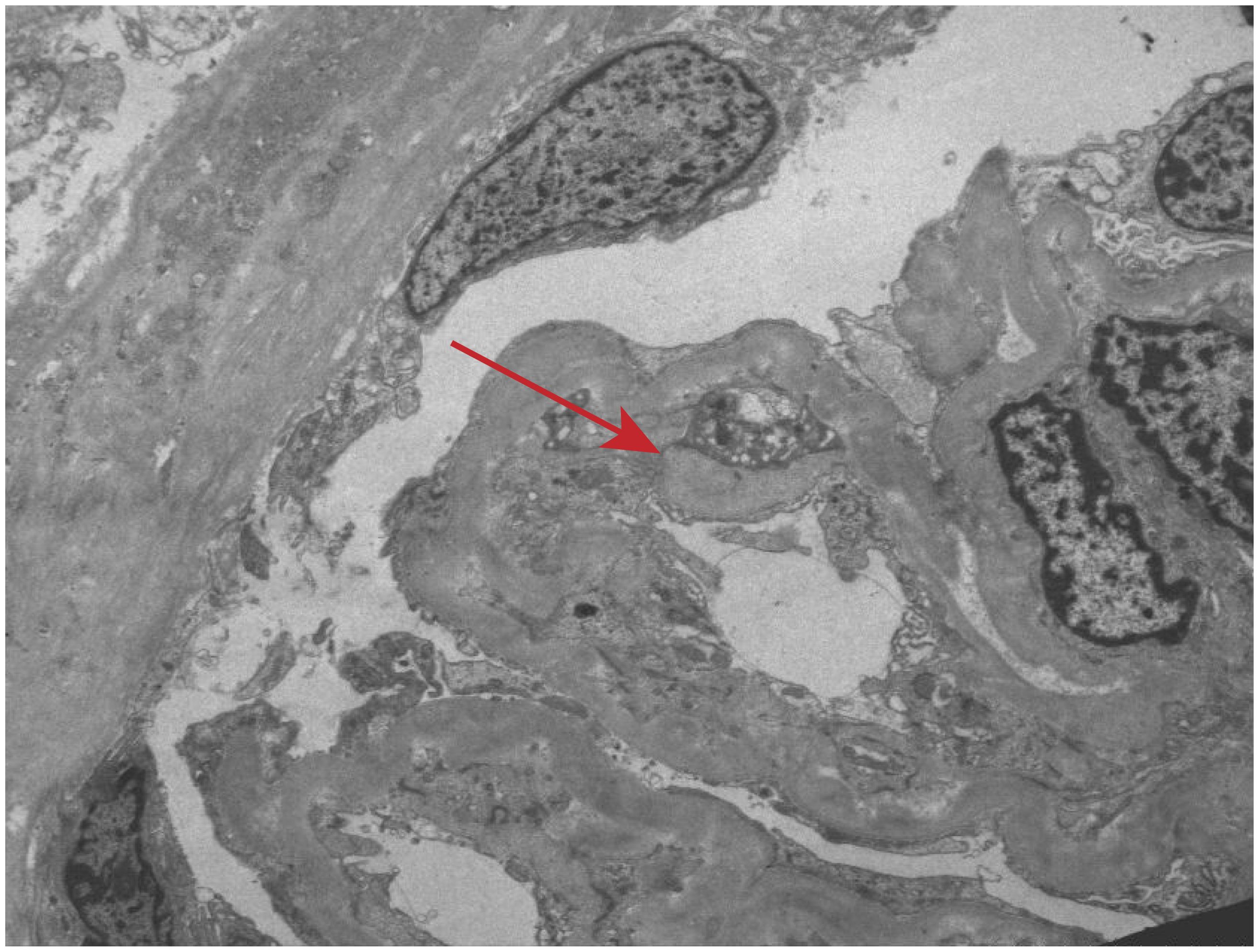 Microscopic image showing tissue with cell structures, highlighted by an arrow. Gray shades depict variations in texture and density, indicating different cellular components. The red arrow points to a specific area of interest within the tissue.