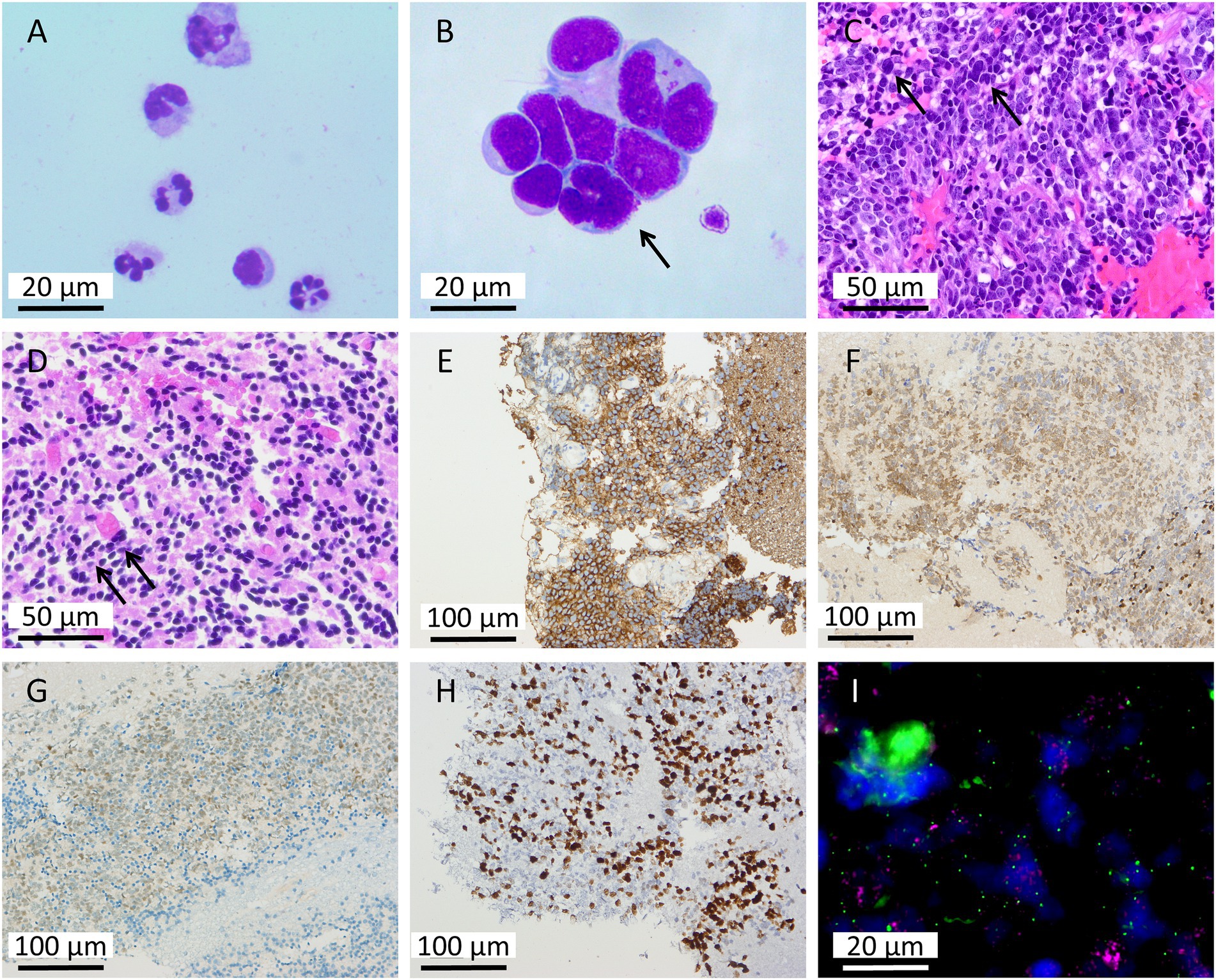 Nine microscopic images labeled A to I, showcasing cell formations and tissue samples under different magnifications. A and B show clustered circular cells; B has one highlighted by an arrow. C and D display densely packed, dark-stained cells with arrows. E, F, G, and H present tissue sections stained in different shades, showing varied cell distribution. I depicts a colorful image with bright green, blue, and red hues indicating cellular components. Scale bars for measurement are present in each image.