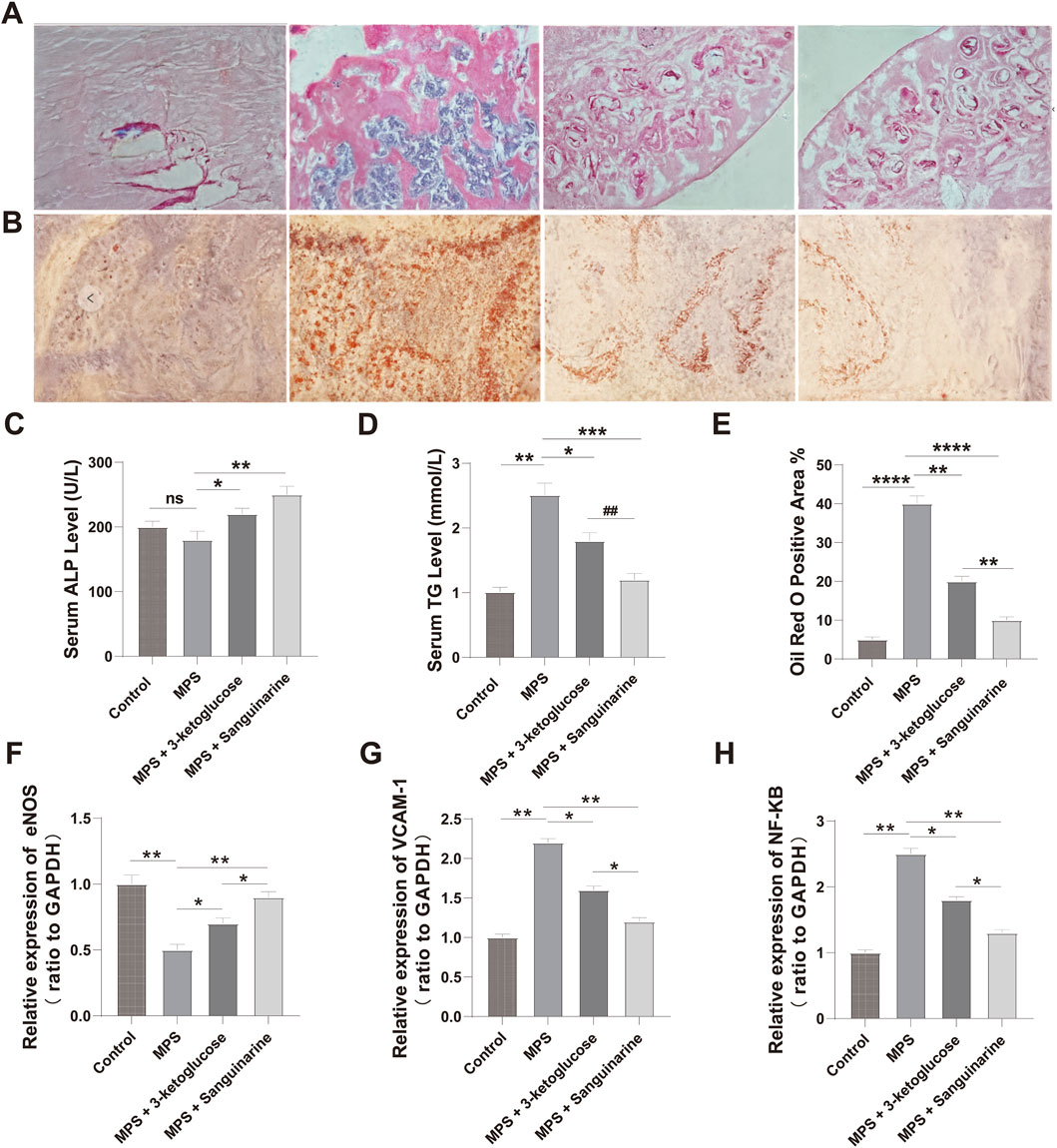 Panel A shows stained tissue sections with varying degrees of histological changes. Panel B displays tissue with different staining intensities. Graph C presents serum ALP levels across four groups, showing significance with asterisks. Graph D illustrates serum triglyceride levels with similar significance indicators. Graph E depicts the percentage of Oil Red O positive area. Graphs F, G, and H show relative expression levels of eNOS, VCAM-1, and NF-kB, respectively, normalized to GAPDH. Each graph includes significance denoted by asterisks and symbols.