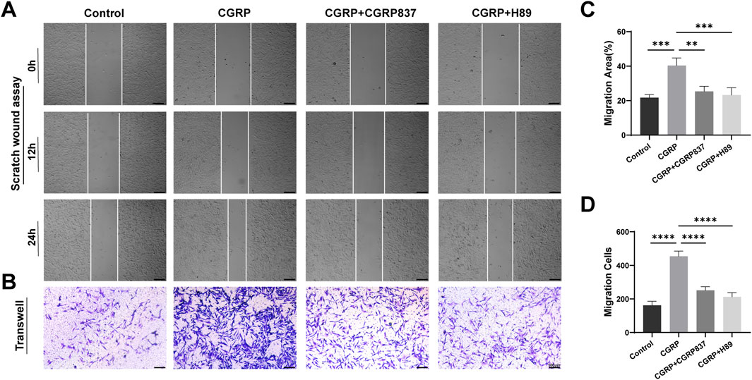 Scratch wound and Transwell assay images showing cell migration under different conditions: Control, CGRP, CGRP+CGPR837, and CGRP+H89. Time intervals are 0, 12, and 24 hours. Bar graphs (C, D) display migration area and cell counts, respectively, indicating significant differences across treatments.