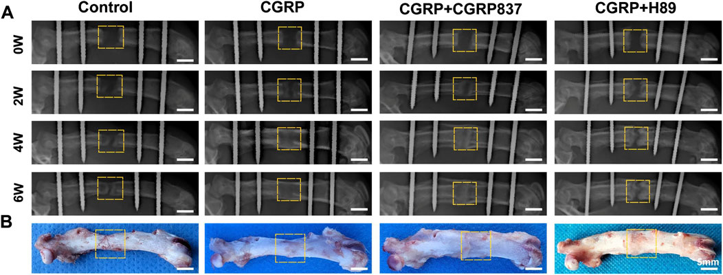 X-rays and photographs of bone samples showing changes over time under different conditions: Control, CGRP, CGRP+CGRP837, and CGRP+H89. X-rays (A) show progression at zero, two, four, and six weeks with highlighted areas. Photographs (B) display corresponding bone samples with marked sections. Scale bars are included for reference.