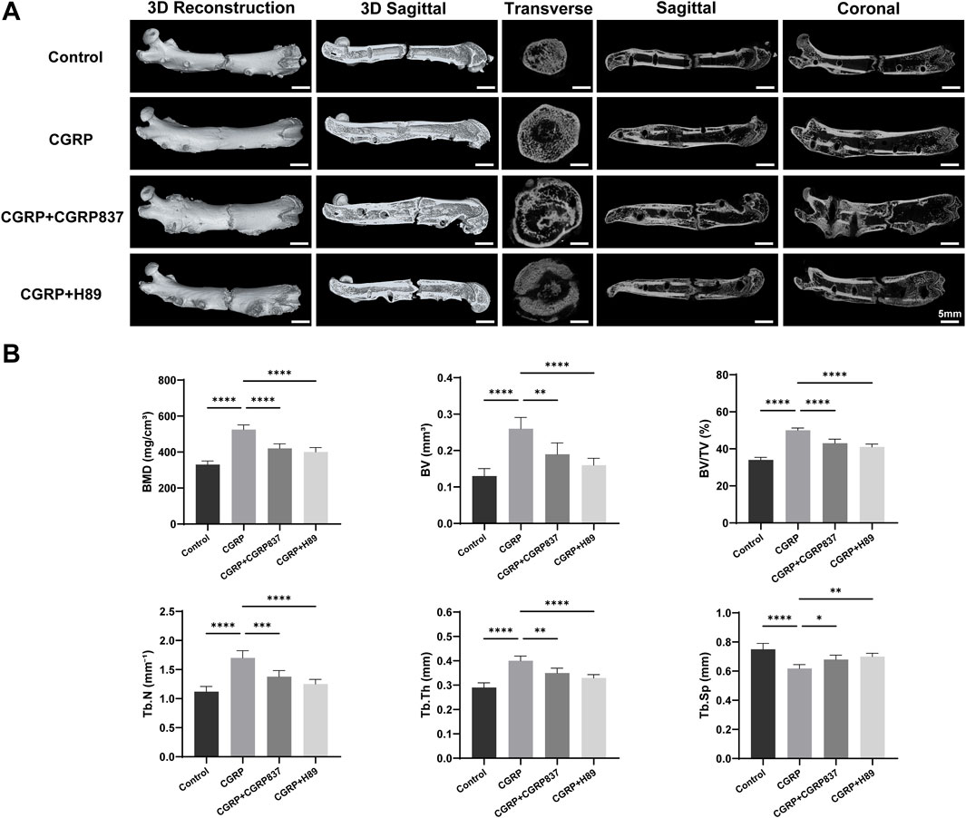 Panel A shows bone scans in different planes: 3D reconstruction, 3D sagittal, transverse, sagittal, and coronal. Rows include Control, CGRP, CGRP+CGRP837, and CGRP+H89 conditions. Panel B presents bar graphs comparing bone metrics: Bone Mineral Density (BMD), Bone Volume (BV), Bone Volume/Total Volume (BV/TV), Trabecular Number (Tb.N), Trabecular Thickness (Tb.Th), and Trabecular Separation (Tb.Sp) across the same conditions, with significant differences indicated by asterisks.