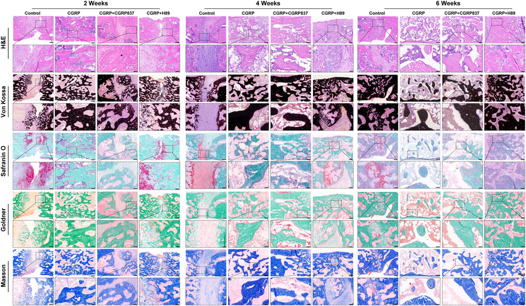Microscopic images showing bone healing over two, four, and six weeks for different treatments: Control, CGRP, CGRP and CGRP837, CGRP and H89. Rows display different staining techniques: H&E, Von Kossa, Safranin O, Goldner, and Masson. Each treatment has a set of images highlighting changes in tissue morphology and calcification.