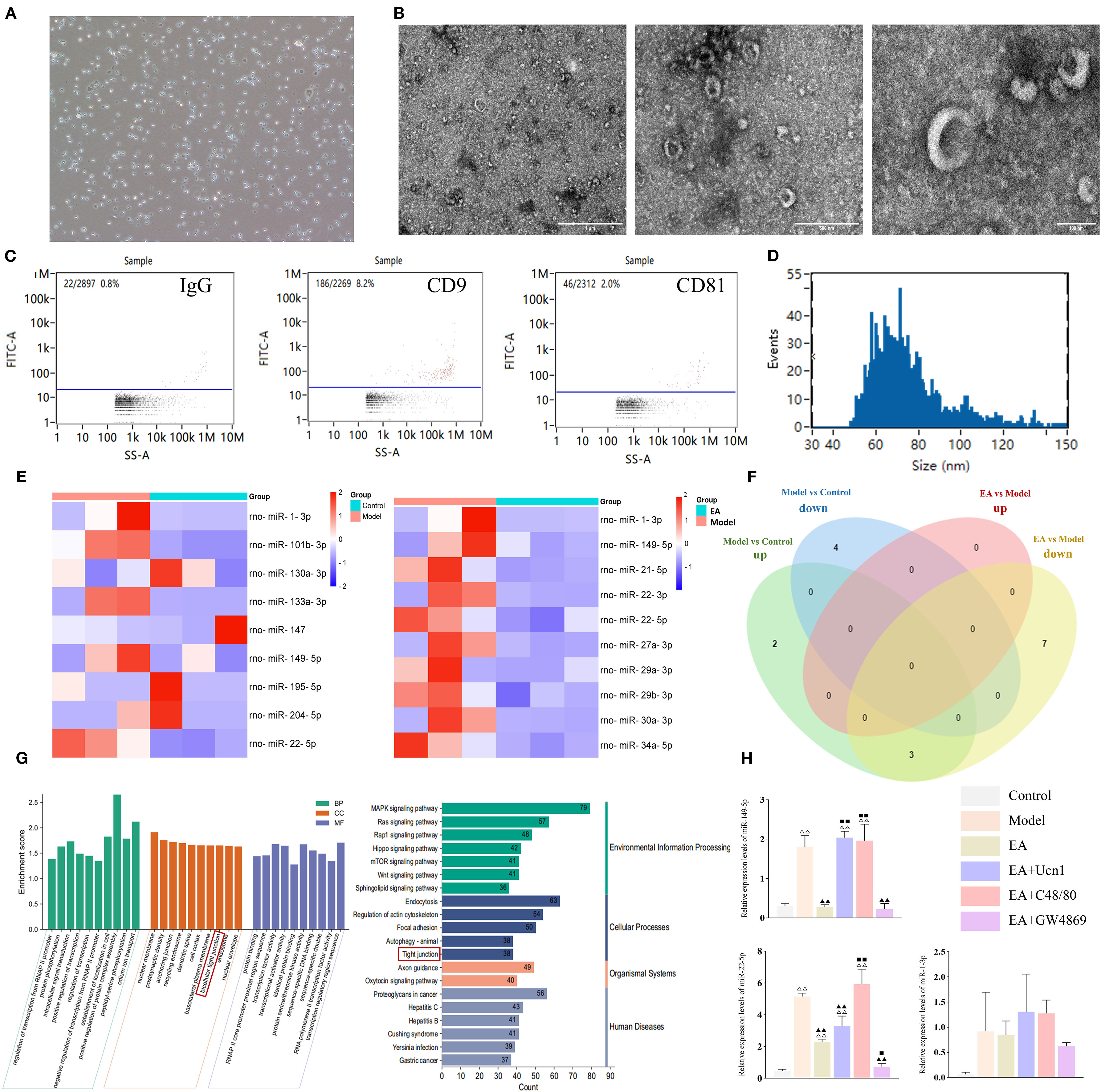 Panel A shows a microscope image of small particles. Panel B contains three electron microscope images displaying circular and irregular structures. Panel C presents three scatter plots measuring fluorescence intensity versus side scatter for IgG, CD9, and CD81. Panel D displays a histogram of particle size distribution. Panel E consists of two heat maps comparing the expression of various microRNAs across different groups. Panel F contains a Venn diagram illustrating overlap in gene expression changes between groups. Panel G shows bar graphs of enriched pathways categorized by color. Panel H includes four bar graphs comparing data across different experimental conditions.
