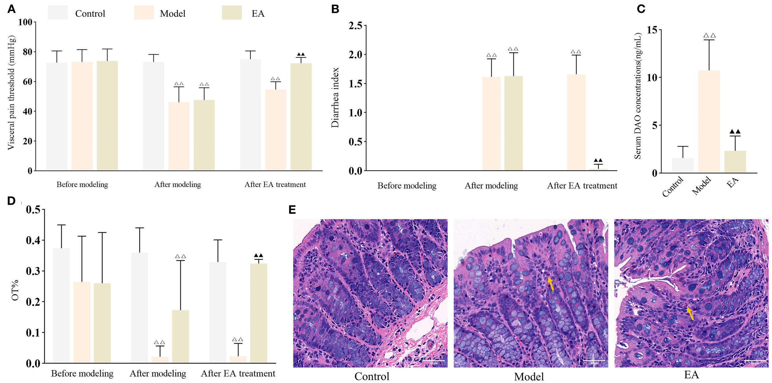 Graphical data showing the effects of treatment on various parameters, including visceral pain threshold (A), diarrhea index (B), serum DAO concentrations (C), and OT percentage (D), across control, model, and EA groups, with significant differences indicated. Micrographs (E) compare tissue morphology among the control, model, and EA treatments, highlighting changes with arrows.