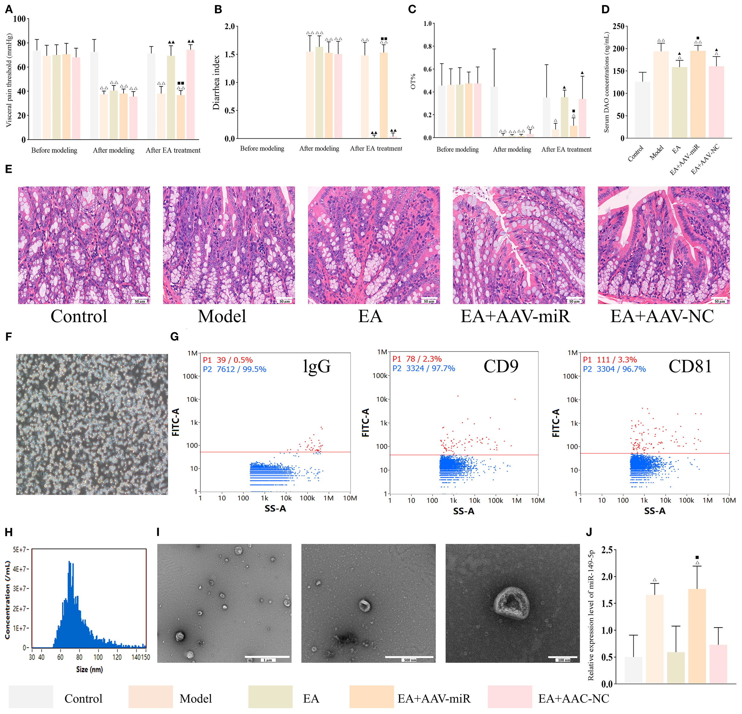 Graphs A-D display metrics such as visceral pain threshold, diarrhea index, and related measures before and after modeling and EA treatment. E shows histological images from control, model, and treatment groups. F presents a cell image. G depicts dot plots for IgG, CD9, and CD81 expression. H shows a size distribution histogram. I includes microscopic images of particles. J is a bar graph of miRNA-9 expression across groups.