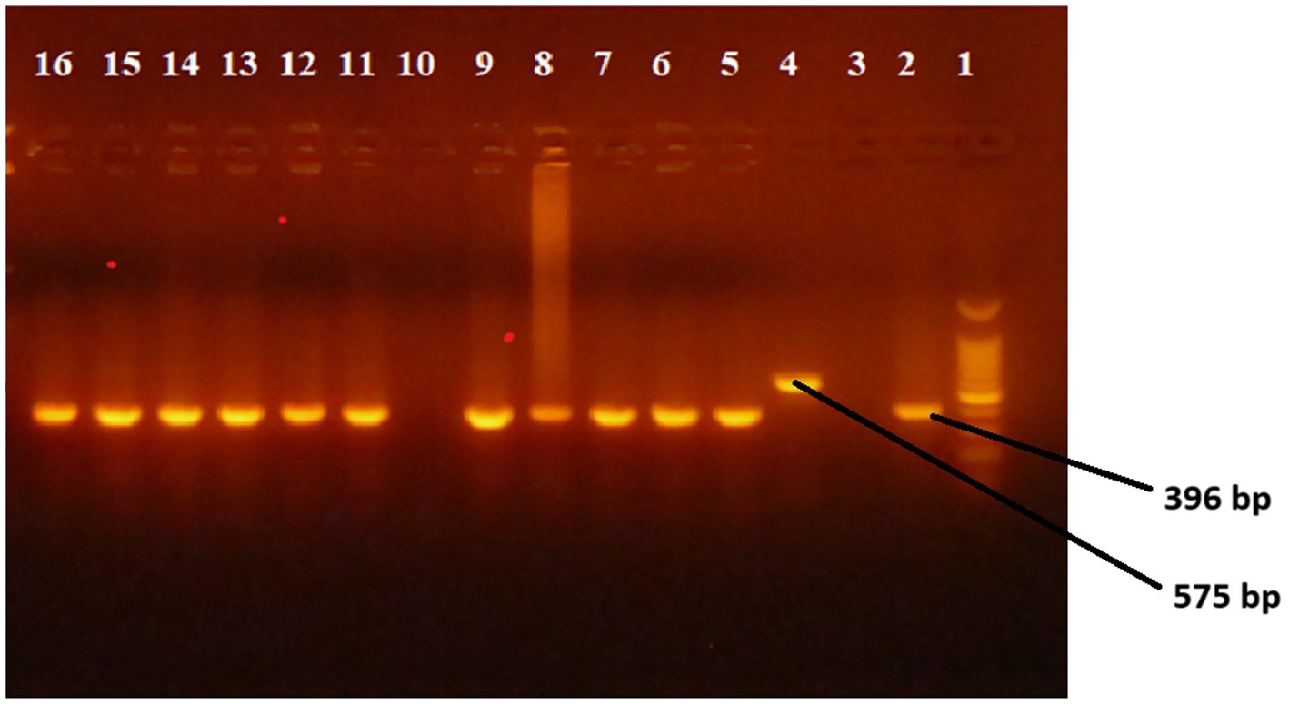 Gel electrophoresis image showing lanes numbered one to sixteen. Bright bands are visible in each lane, indicating DNA fragments. Lanes five and eight have highlighted bands at 396 base pairs and 575 base pairs.