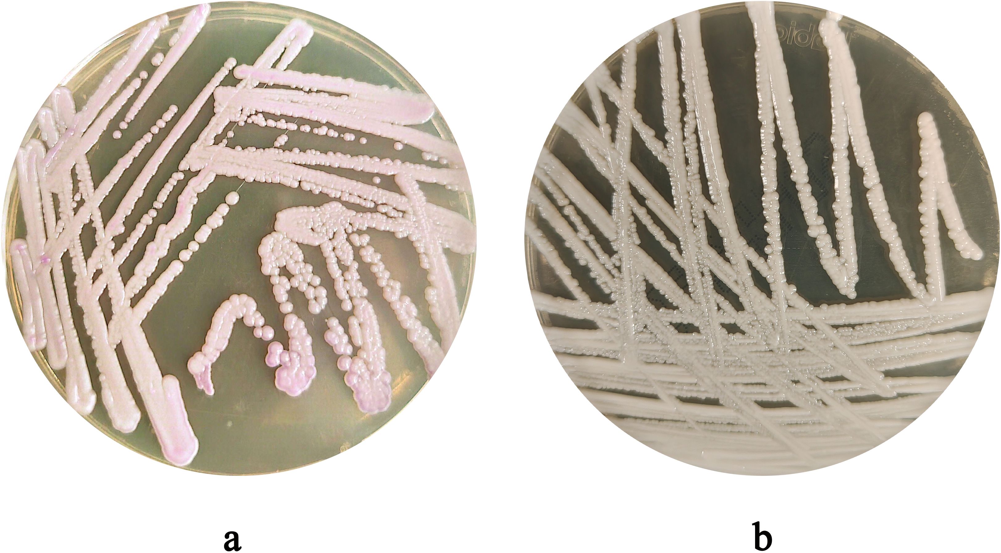 Petri dishes labeled “a” and “b” with streaked bacterial cultures. Dish “a” shows pinkish clusters, while dish “b” has white colonies. Both exhibit dense, linear growth patterns.
