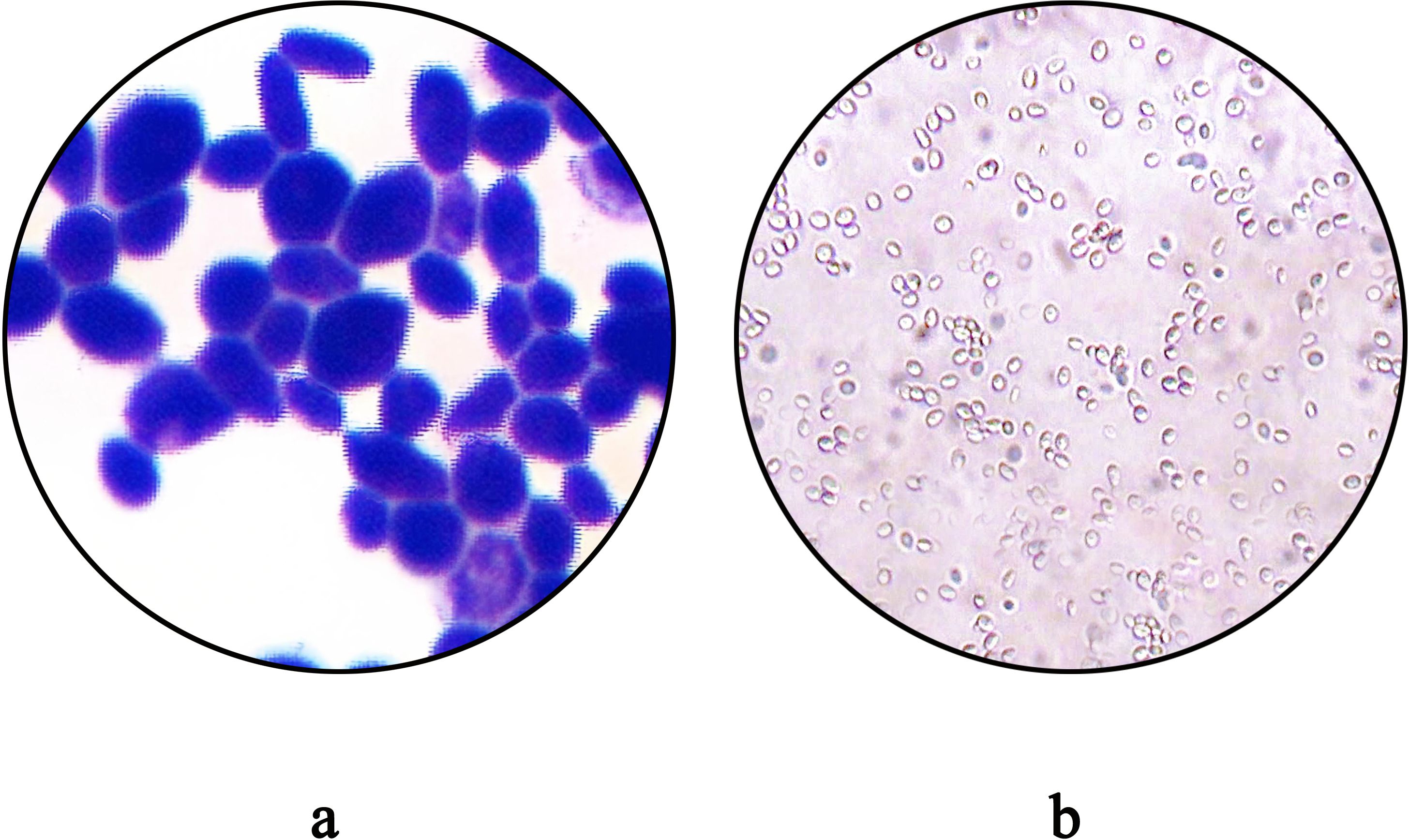 Microscopic images show two different views. Image a displays clusters of dark purple, densely packed, oval-shaped cells, likely stained for clarity. Image b illustrates numerous small, light-colored, circular cells spread out more sparsely, with less dense pigmentation. Both images are encapsulated in circular frames.