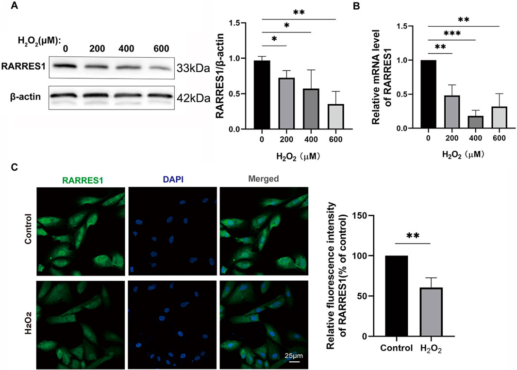 Experimental results showing the effect of hydrogen peroxide (H₂O₂) concentrations on RARRES1 expression. Panel A: Western blot of RARRES1 and β-actin, displaying decreasing RARRES1 levels with increasing H₂O₂ concentrations. Panel B: Bar graph of RARRES1 mRNA levels, showing reduction with higher H₂O₂ concentrations, statistically significant at various levels marked by asterisks. Panel C: Immunofluorescence images with RARRES1 in green and DAPI-stained nuclei in blue, indicating reduced RARRES1 fluorescence after H₂O₂ treatment. A bar graph shows the relative fluorescence intensity compared to control.