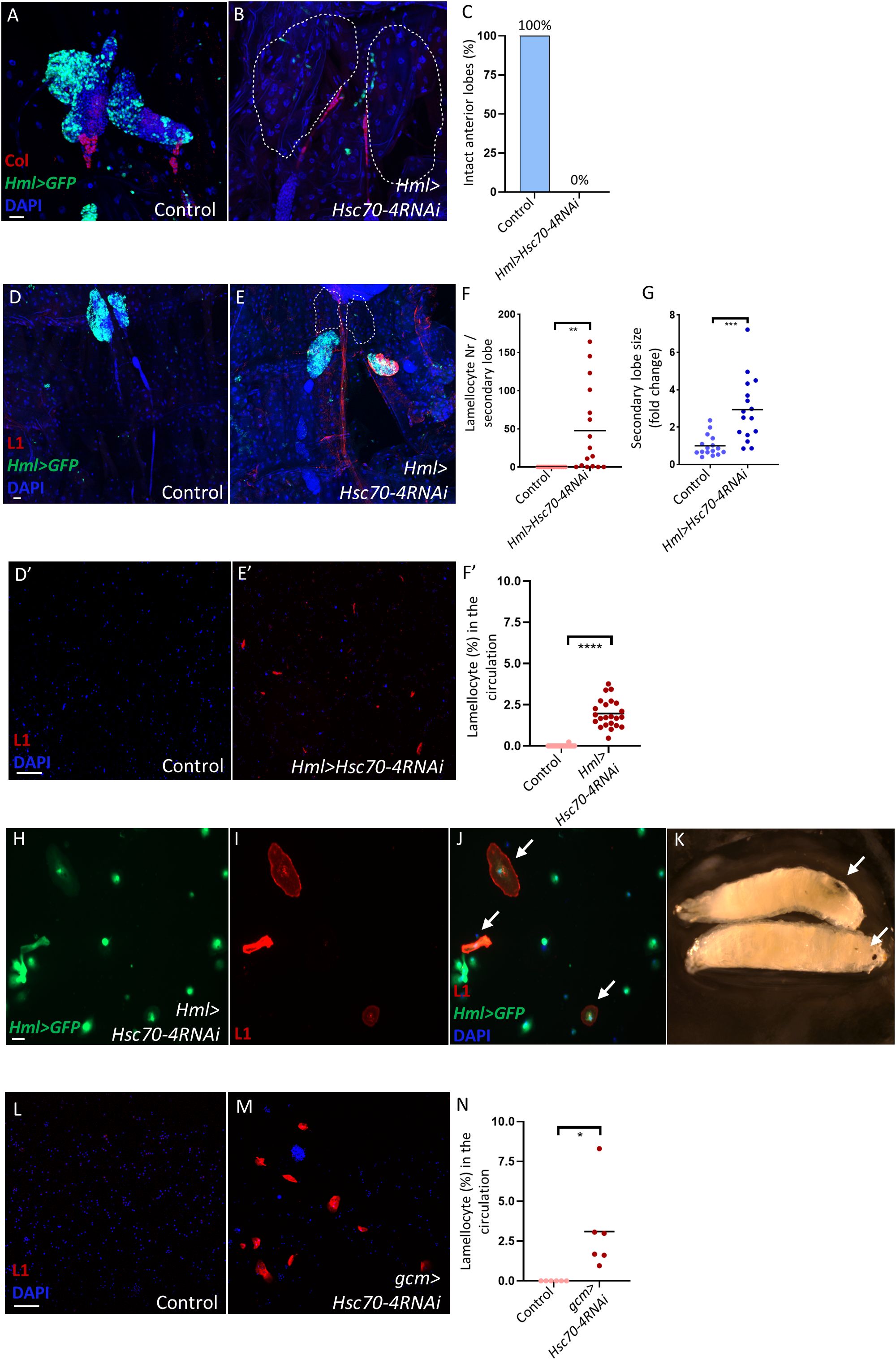 Fluorescent microscopy images and graphs illustrate different experimental outcomes in Drosophila. Panels A and B show comparisons of anterior lobes under control and Hsc70-4RNAi conditions. Panel C presents a bar graph demonstrating the percentage of intact anterior lobes. Panels D and E compare lamellocyte distribution in control and Hml>Hsc70-4RNAi lymph gland samples. Panel F shows a dot plot for lamellocyte number per secondary lobe, and Panel G displays secondary lobe size changes. Panels D', E', and F' focus on lamellocyte presence in circulation. Panels H to J highlight different lamellocytes in circulation. Panel K shows a larva with pointed arrows, and panels L and M compare lamellcoyte levels in the circulation of the control and gcm>Hsc70-4RNAi larvae, with panel N showing lamellocyte percentage quantifications.
