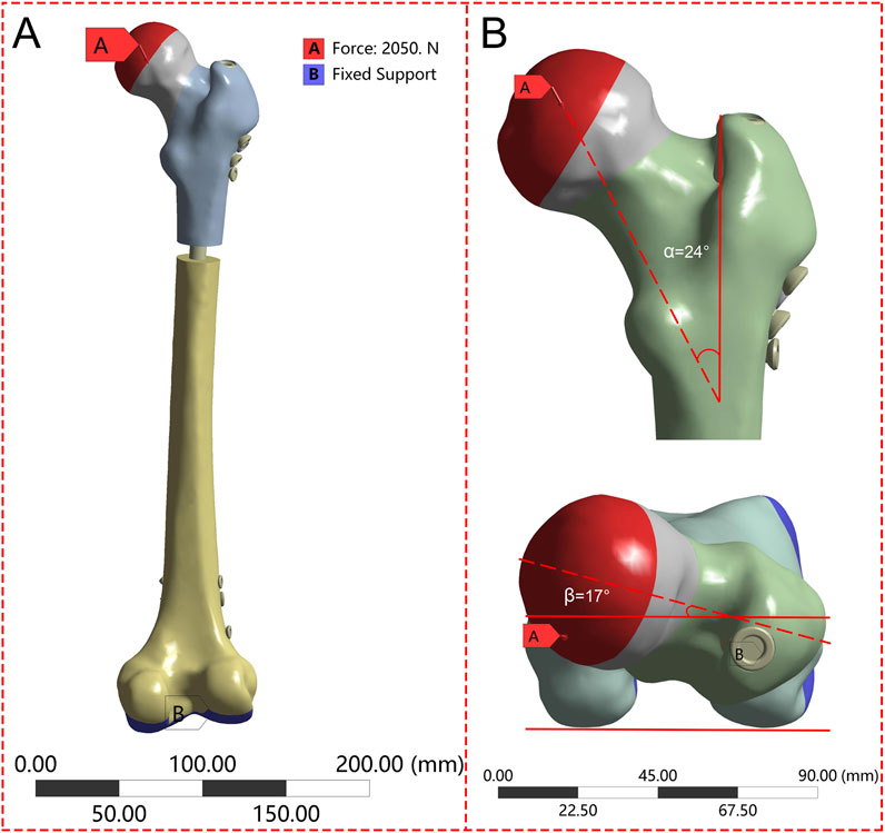 Diagram showing two views of a femur model. Panel A: Side view illustrating a red arrow labeled