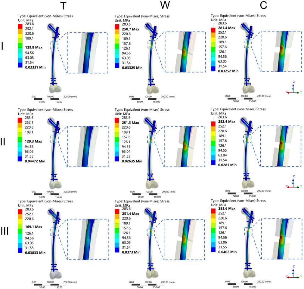 Simulation graphs display equivalent (von-Mises) stress distributions for three configurations (T, W, C) across three conditions (I, II, III). Each graph includes a color scale ranging from 31.54 to 283.6 megapascals and highlights maximum and minimum stress values. Magnified insets show detailed stress regions. Axes indicate dimensions in millimeters.