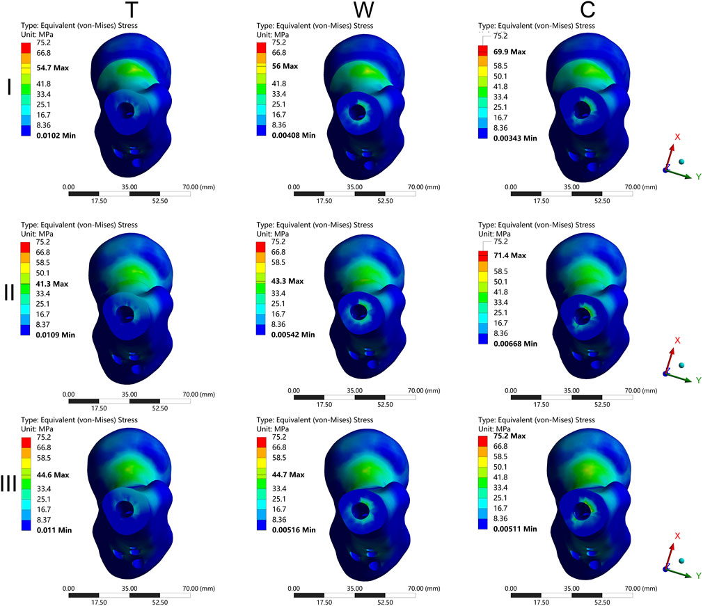 Three rows and three columns of contour plots show the Equivalent (von-Mises) Stress in megapascals for models labeled T, W, and C. Each column represents a model, and each row represents a different load condition. Stress levels range from 8.36 to 75.2 MPa, indicated by a color scale from blue to red. Minimum and maximum stress values are annotated on each plot. A 3D coordinate system is included for spatial orientation.