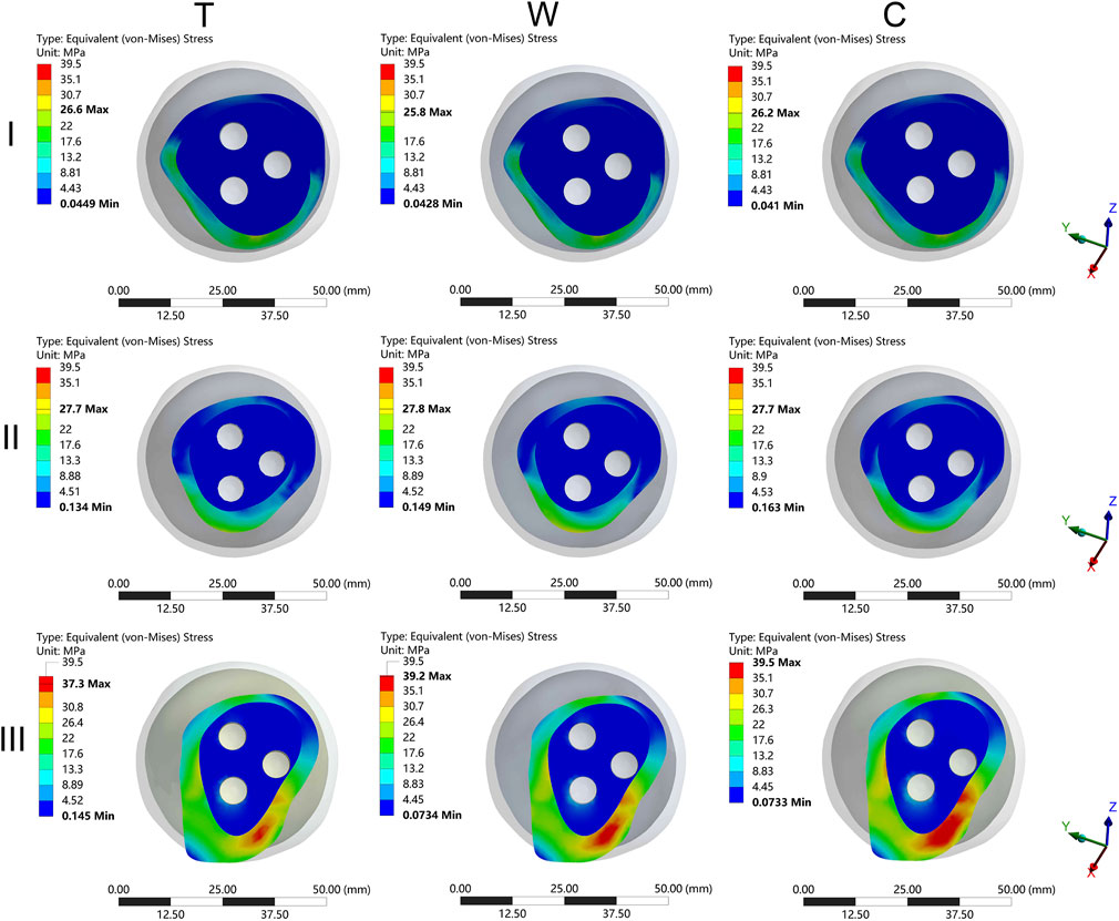 Nine diagrams illustrate equivalent von Mises stress distributions in a cylindrical object with three holes. The diagrams are organized in three rows and three columns labeled T, W, and C with rows I, II, and III. Stress values range from approximately 0.04 to 39.5 MPa, indicated by a color gradient from blue (lowest) to red (highest). Scale bars indicate dimensions in millimeters. Axes are marked for orientation in the Y, Z, and X directions.