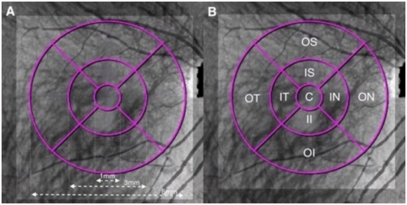Two grayscale images labeled A and B show circular grids overlaid on a background with branching patterns, likely retinal scans. Each grid is divided into sectors with labels including C, IS, IN, ON, OT, OS, IT, and OI. There are concentric circles and radial lines, with measurement markers showing 1 millimeter, 3 millimeters, and 6 millimeters in image A.