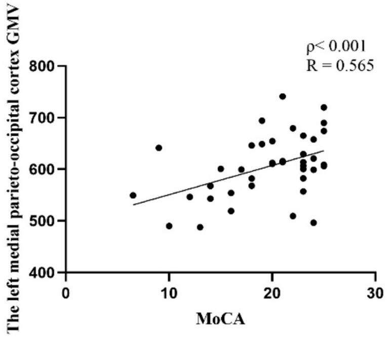 Scatter plot showing the relationship between the left medial parieto-occipital cortex GMV and MoCA scores. The x-axis represents MoCA scores from 0 to 30, and the y-axis shows GMV values from 400 to 800. Dots indicate data points, and a trend line shows a positive correlation. Statistical values are rho less than 0.001 and R equals 0.565.