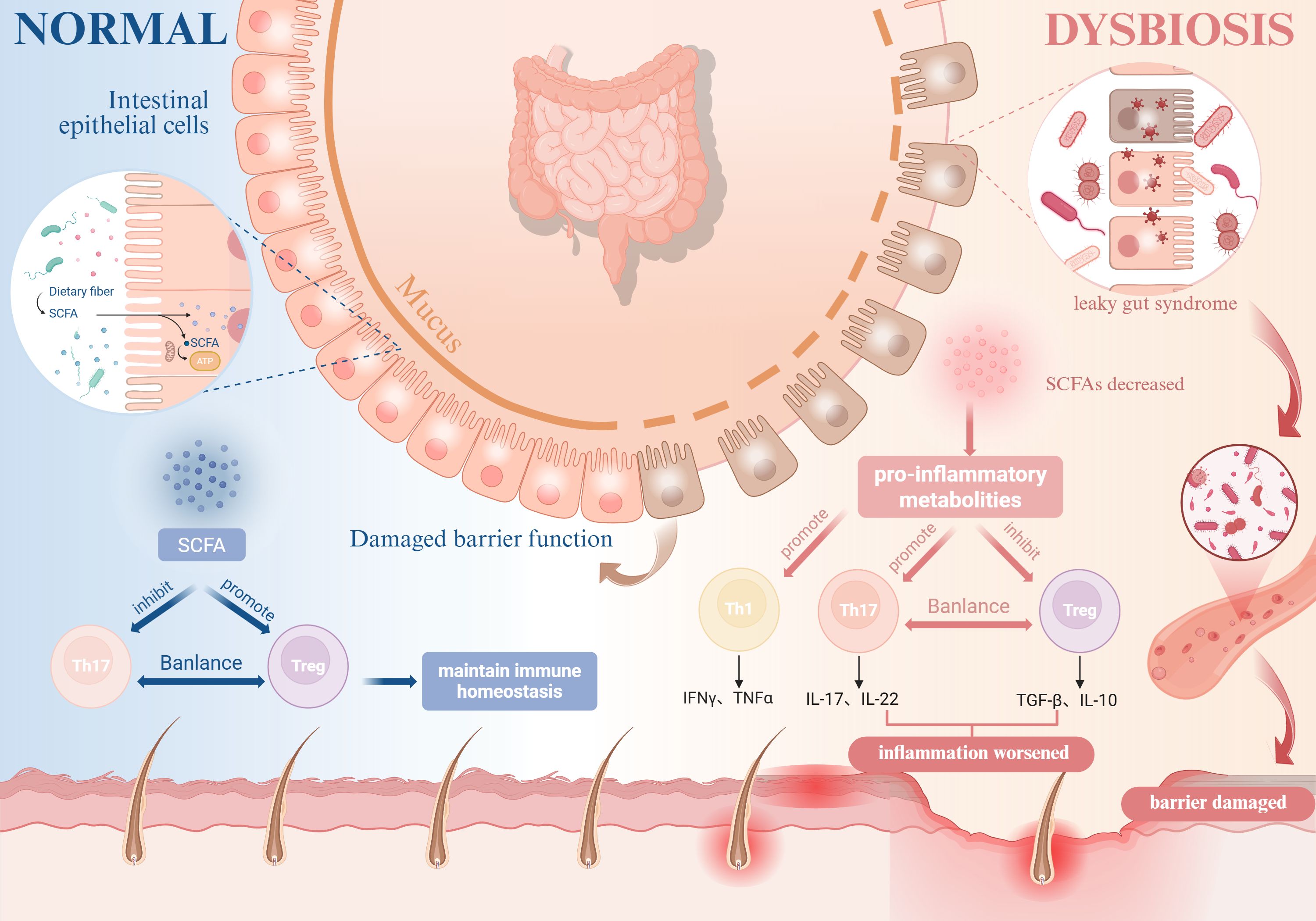 Diagram comparing normal and dysbiotic intestinal environments. On the left, a healthy intestine shows dietary fiber producing short-chain fatty acids (SCFAs), promoting immune homeostasis. On the right, dysbiosis leads to decreased SCFAs and increased pro-inflammatory metabolites, causing leaky gut and inflammation. Arrows indicate the progression toward inflammation and barrier damage.