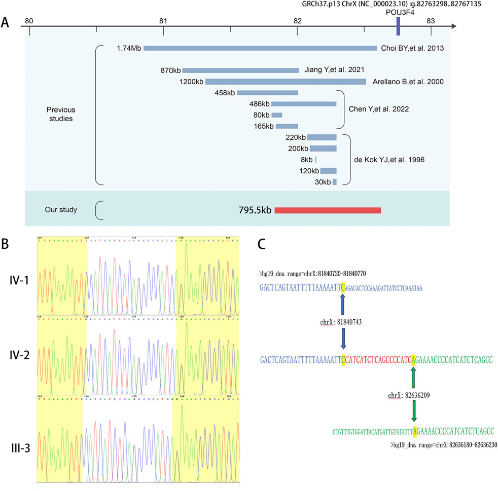 Diagram with three sections. A) Timeline comparing genomic studies shows previous research identifying regions from 30kb to 1.74Mb, with the current study identifying 795.5kb. B) DNA sequencing chromatograms for individuals IV-1, IV-2, and III-3. C) DNA sequence with highlighted differences and indicated chromosome X positions: 81840743 and 82636209.
