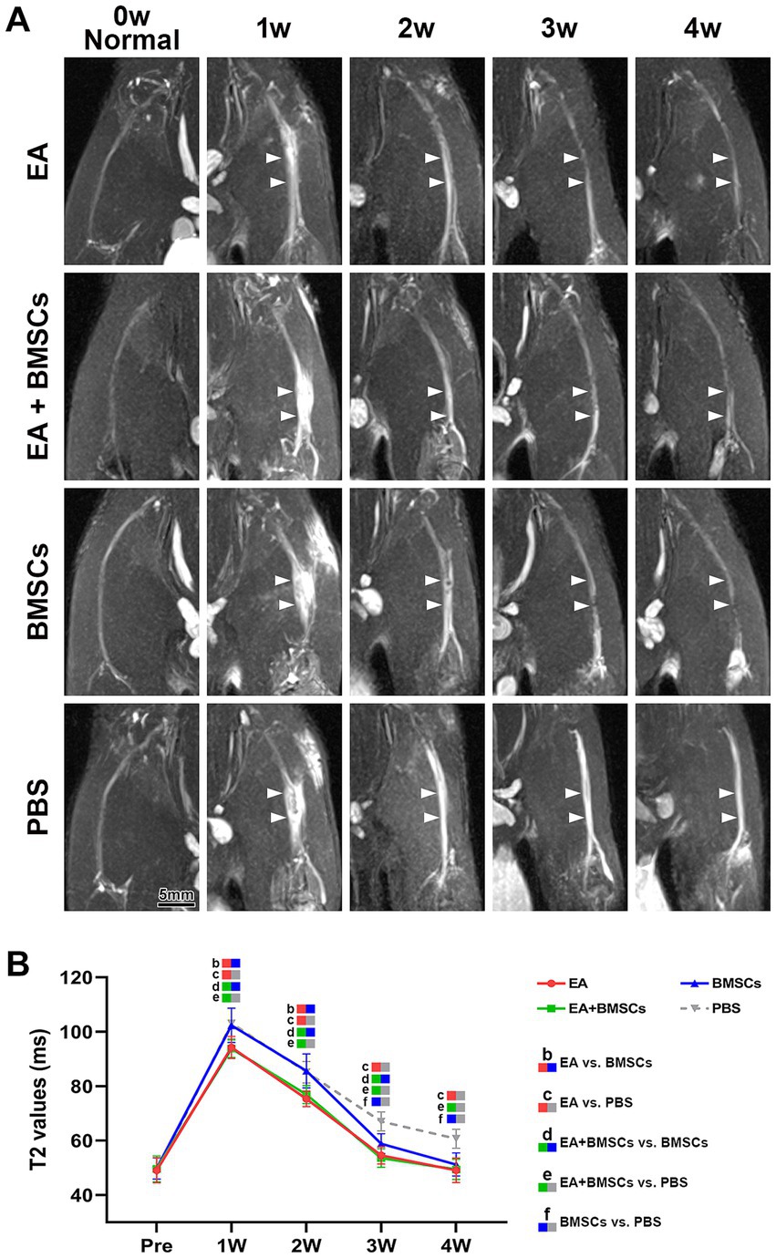 Panel A shows a series of MRI scans illustrating different treatments over time: EA, EA with BMSCs, BMSCs alone, and PBS. Each row represents a treatment, and columns display the weeks, from 0 to 4. Arrows indicate areas of interest. Panel B presents a line graph comparing T2 values over time for each treatment group, with a legend clarifying the color-coded comparisons.